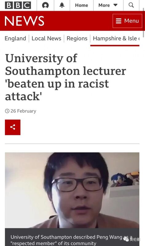 剑桥中国学生自述：被10名青少年暴力殴打至骨折-7.jpg