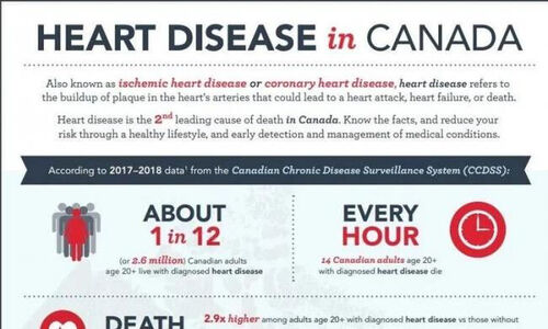加拿大最新研究：这6种食物降低心脏中风风险