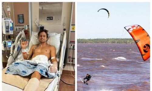 可怕！加拿大27岁男子浮潜遭遇鲨鱼袭击 失去右腿