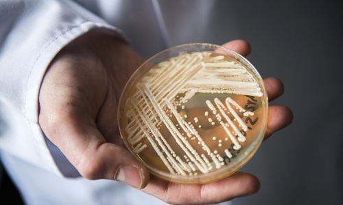 蒙特利尔南岸医院爆发致命的超级真菌 引发恐慌