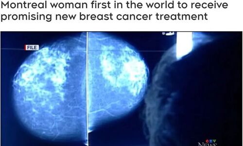 世界首例！蒙特利尔研究出新治疗方法 女子乳房肿块消失